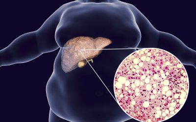 How does obesity lead to fatty liver disease?