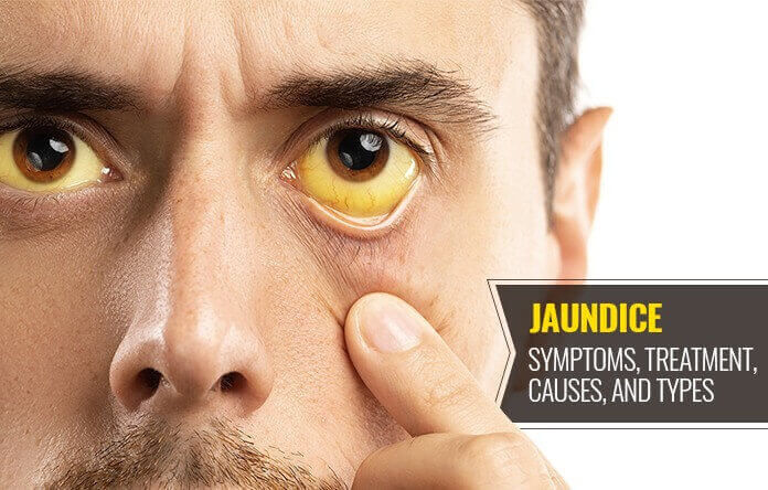 How to recover weakness after jaundice