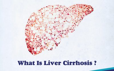 What is Liver Cirrhosis?