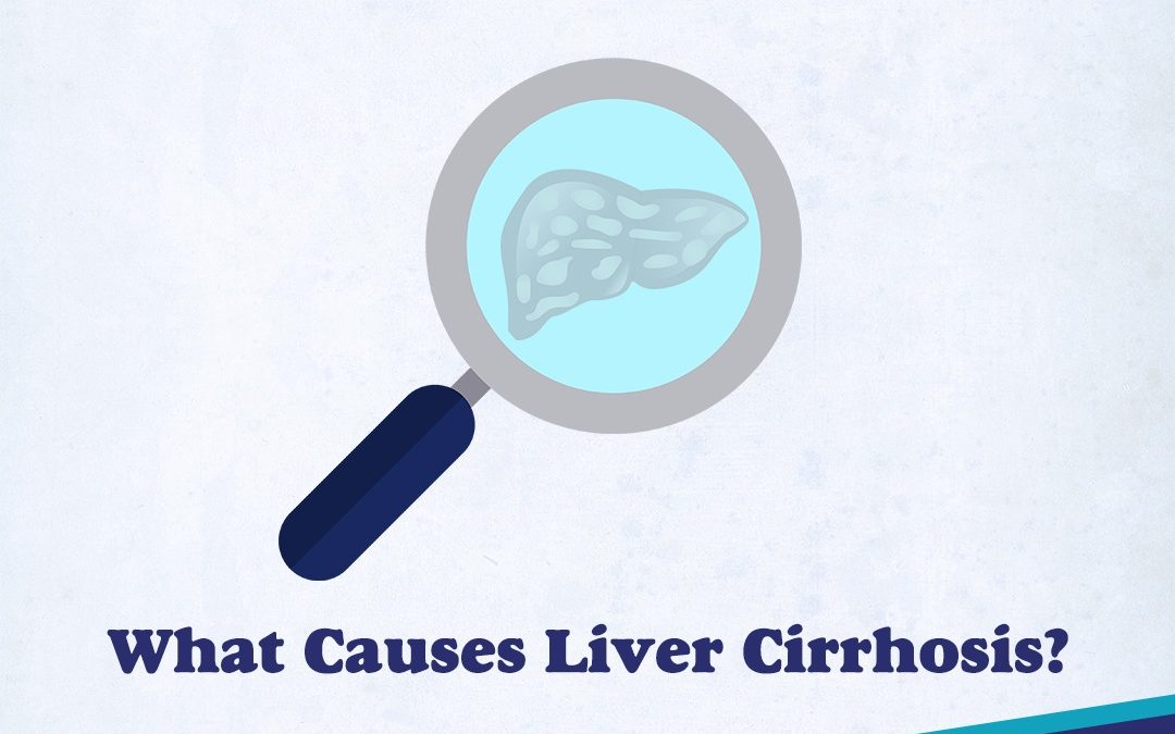Causes of Liver Cirrhosis