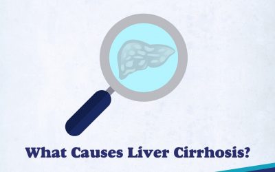 Causes of Liver Cirrhosis
