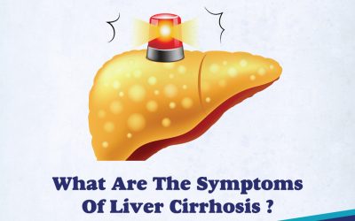 What are the symptoms of liver cirrhosis?