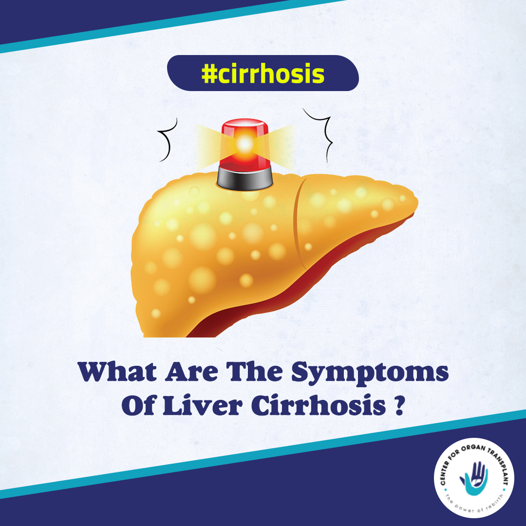 Symptoms of Liver Liver Cirrhosis