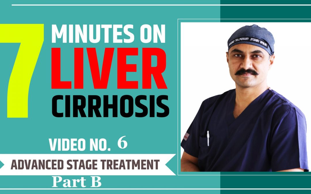 7 Minutes On Liver Cirrhosis – Advanced Stage Treatment of Liver Cirrhosis Part – B