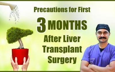 Precautions for First 3 Months After Liver Transplant