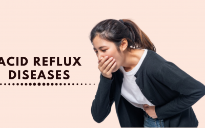 All You Need To Know About Acid Reflux (GERD)