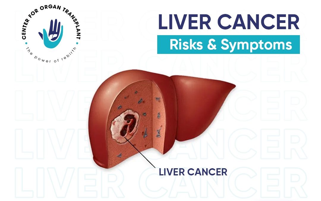 Liver Cancer – Its Risks & Symptoms