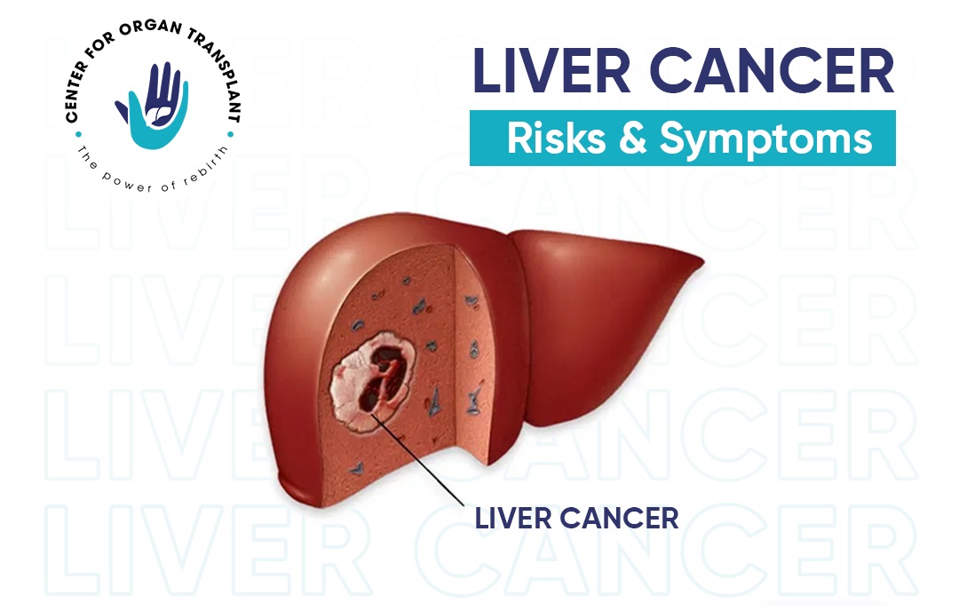 Liver Cancer – Its Risks & Symptoms