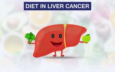 Diet in Liver Cancer