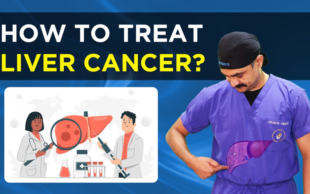 यकृत कर्करोग (लिवर की बीमारी) LIVER CANCER SURGICAL TREATMENT / HINDI