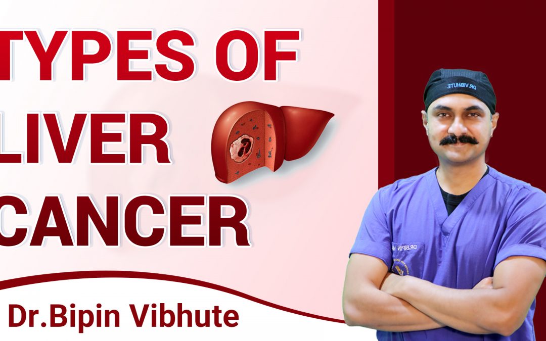 लिवर कैंसर क्या हैं । Liver Cancer Types Hindi: लिवर कैंसर के लक्षण, कारण और बचाव
