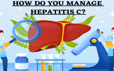 HOW DO YOU MANAGE HEPATITIS C?