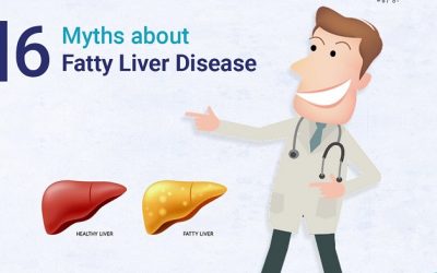 6 Myths About Fatty Liver Disease