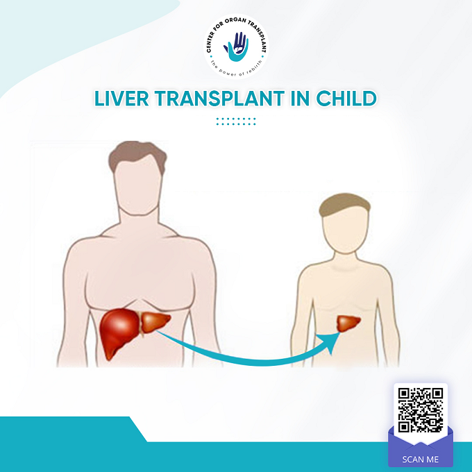 liver transplant in child