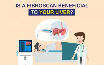 Is a Fibroscan Beneficial to Your Liver?
