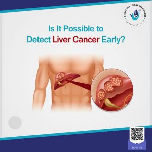 liver cancer