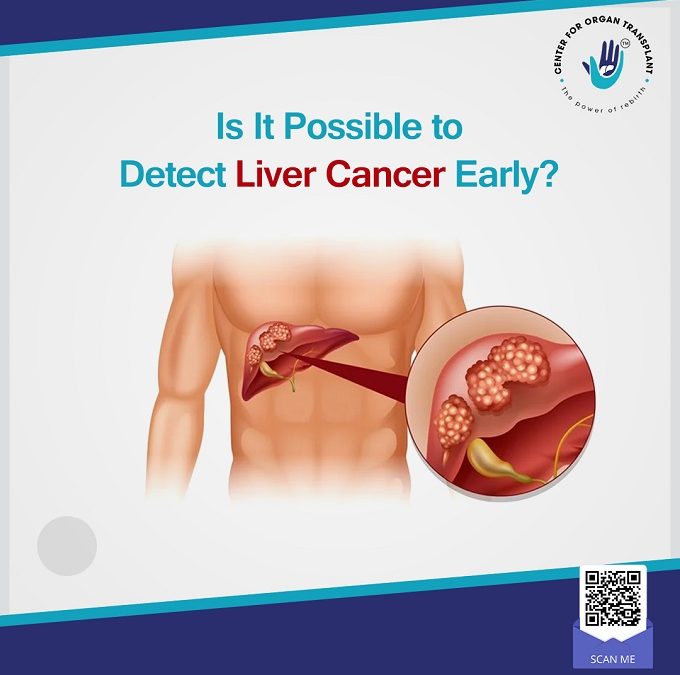 Is It Possible to Detect Liver Cancer Early?