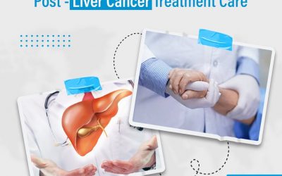 Post-Liver Cancer Treatment Care