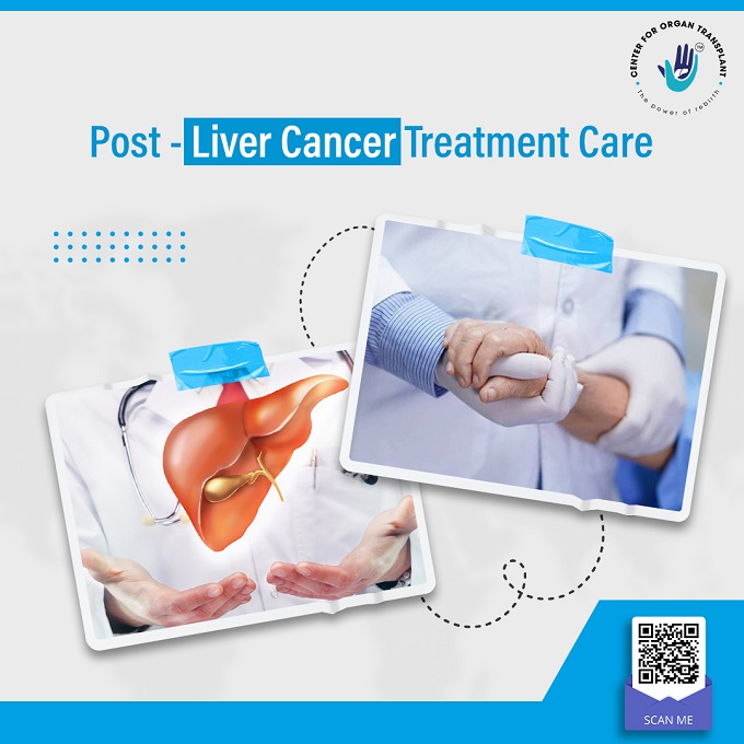 Post-Liver Cancer Treatment Care