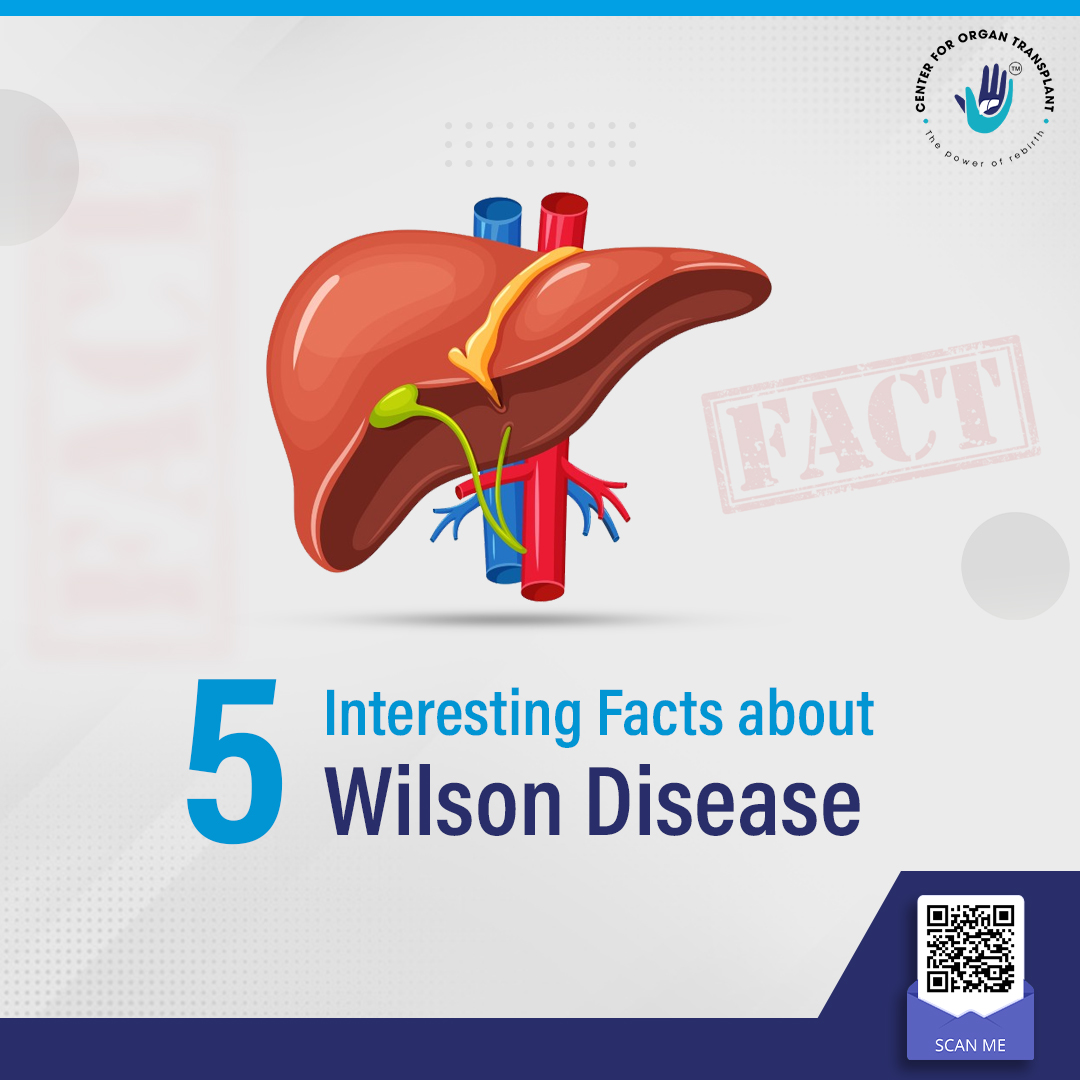 6 Interesting Facts about Wilson’s Disease