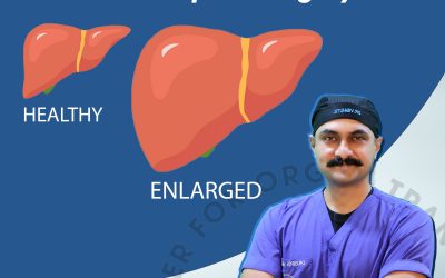 क्या आपके लीवर में सूजन है ? Do You Have Swelling in Your Liver ? Hepatomegaly? – Dr. Bipin Vibhute