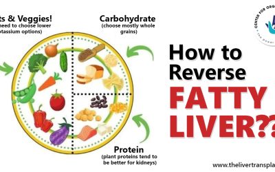 How to reverse fatty liver ??