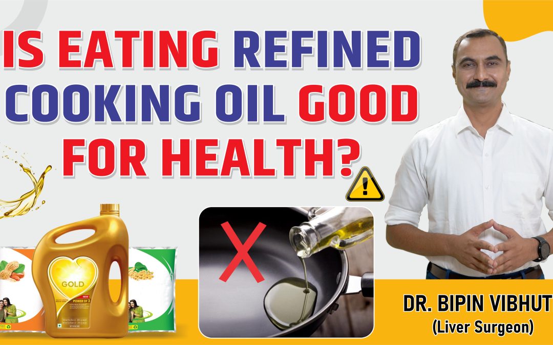 Is Eating Refined cooking oil good for health ?