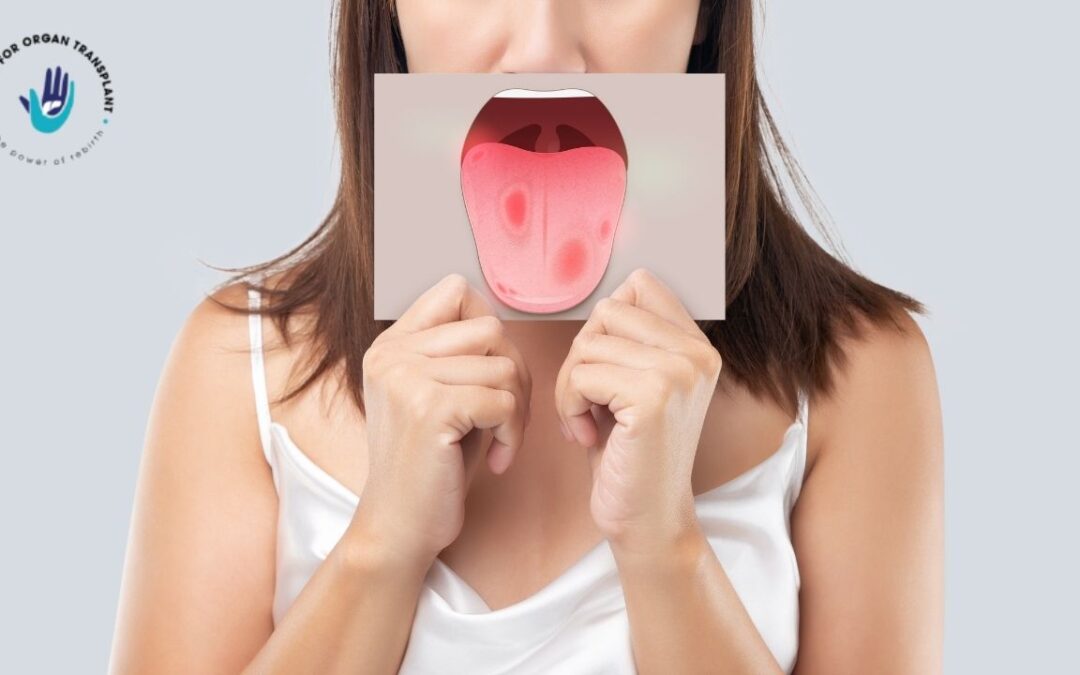 Is That a Harmless Mouth Ulcer or a Warning Sign of Oral Cancer? Dr. Bipin Vibhute, The Liver Guru, Explains