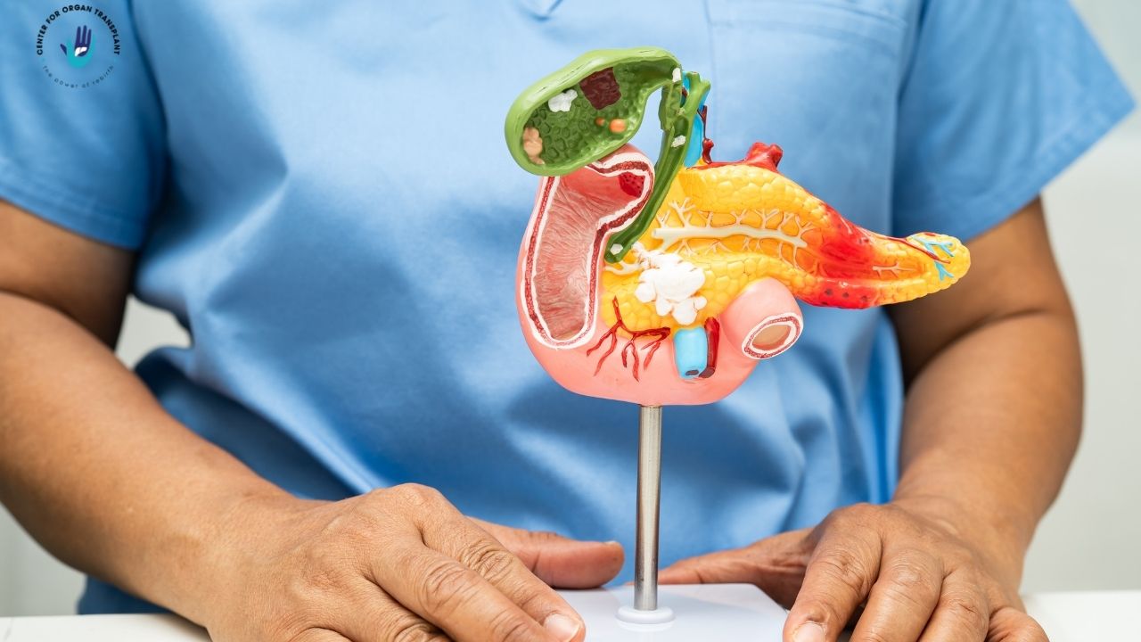 Cost of pancreas transplant in India – surgery and treatment details