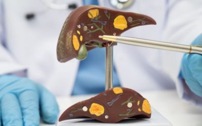 Which Doctor Treats Fatty Liver? When to Consult a Liver Specialist