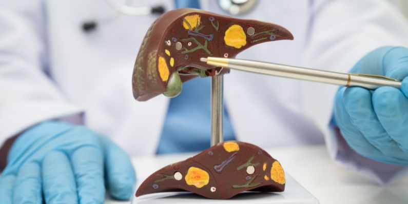 Which Doctor Treats Fatty Liver_ When to Consult a Liver Specialist
